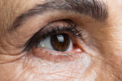 Significant eye abnormalities found in severe Covid-19 patients