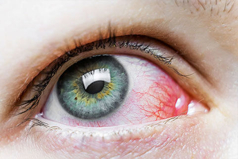 Research reveals how Covid-19 affects the eyes